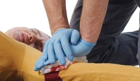 Controlling Severe Bleeding