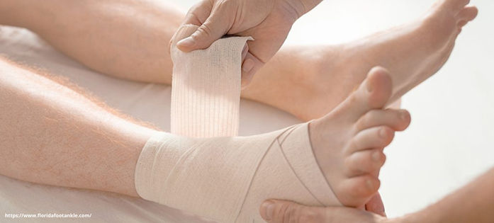 Treating Sprains and Strains